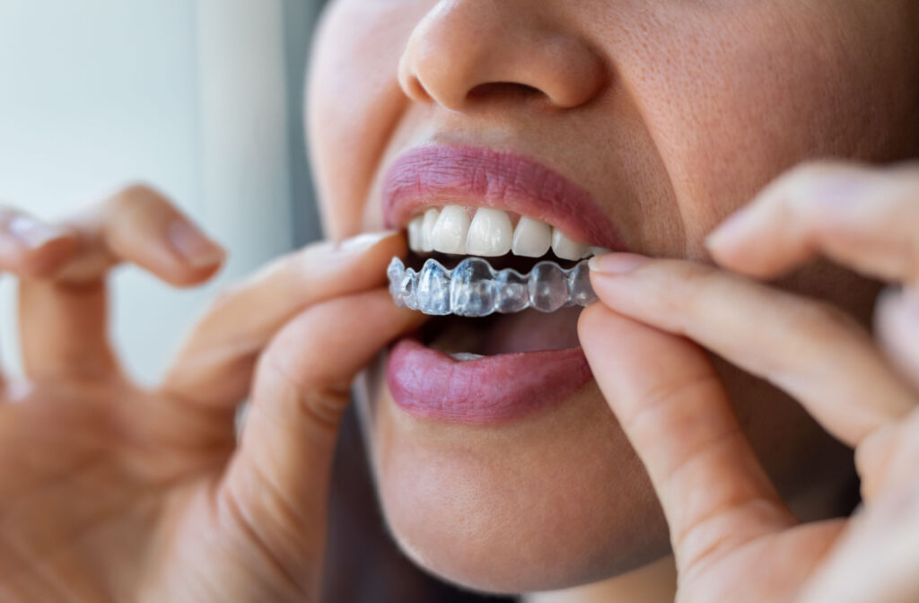 A close up of a woman holding her Invisalign up to her mouth with both hands.