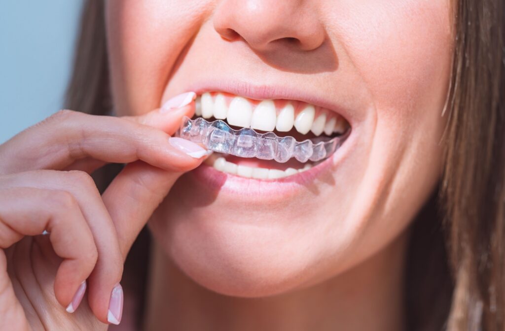 Woman putting on clear aligners.