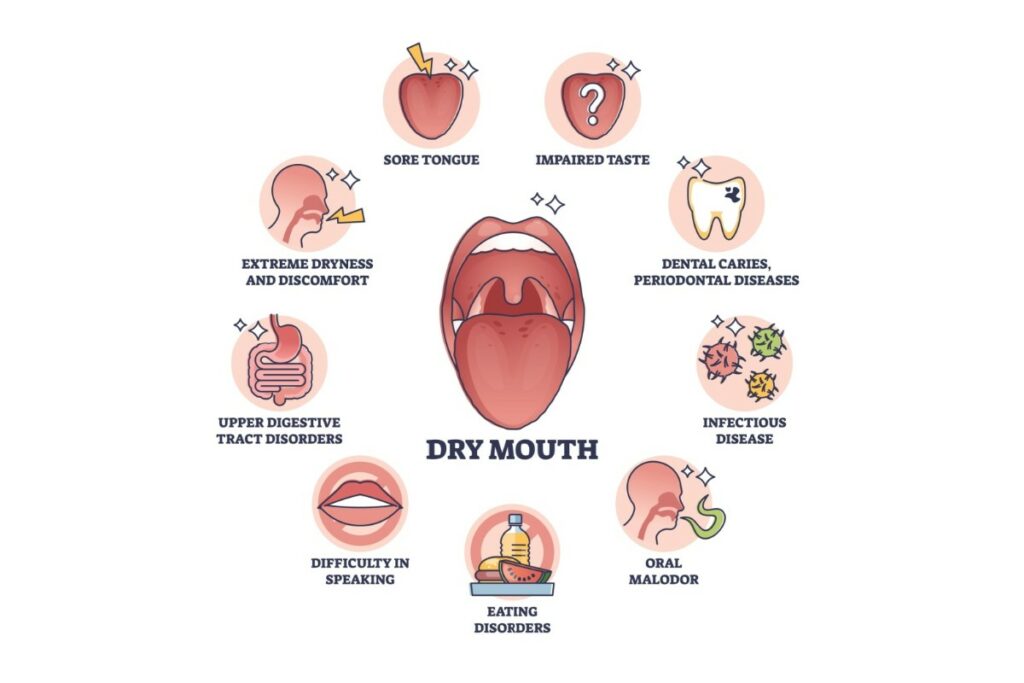 A medical infographic titled 'DRY MOUTH' with a central illustration of an open mouth. Nine surrounding circular icons detail symptoms and related conditions including: sore tongue, impaired taste, dental caries and periodontal diseases, infectious disease, oral malodor, eating disorders, difficulty in speaking, upper digestive tract disorders, and extreme dryness and discomfort.