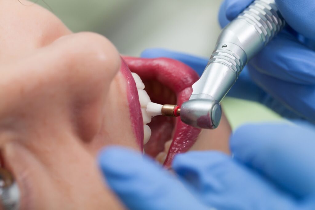 Woman having her teeth polished during dental cleaning.