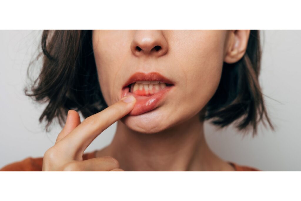 Woman pointing to inflamed gums.